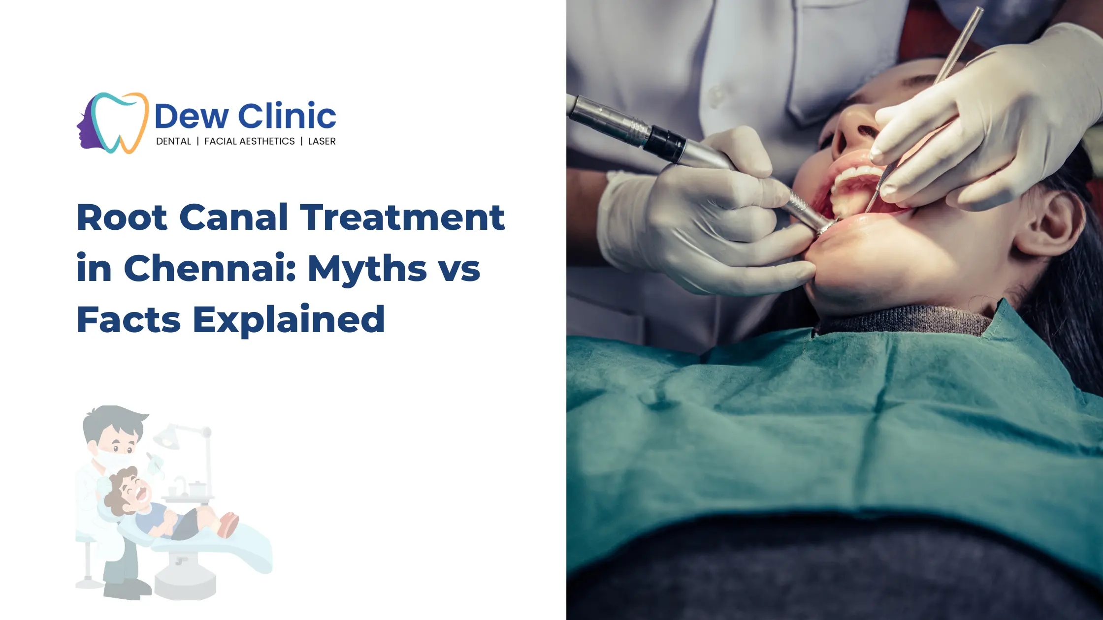 Root Canal Treatment in Chennai