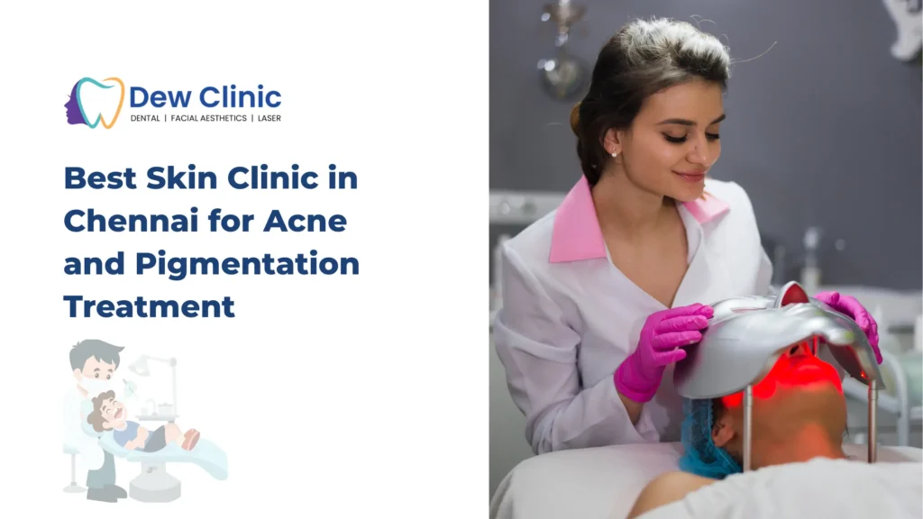 Best Skin Clinic in Chennai for Acne and Pigmentation Treatment