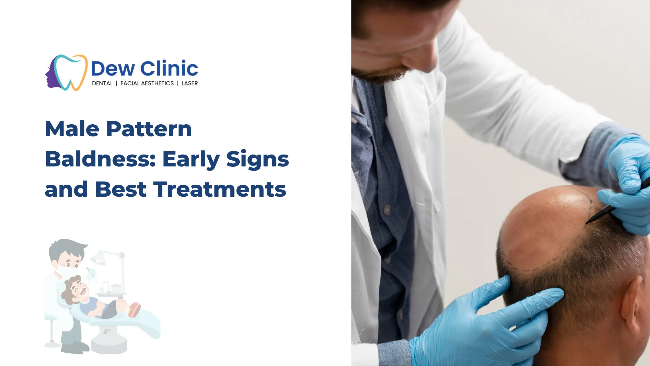 Male Pattern Baldness Early Signs and Best Treatments