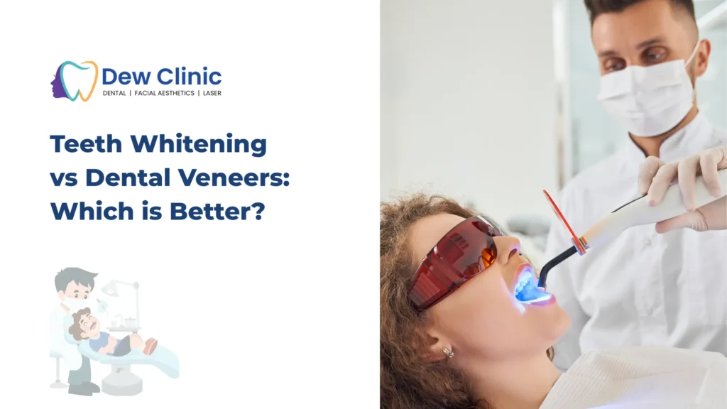Teeth Whitening vs Dental Veneers
