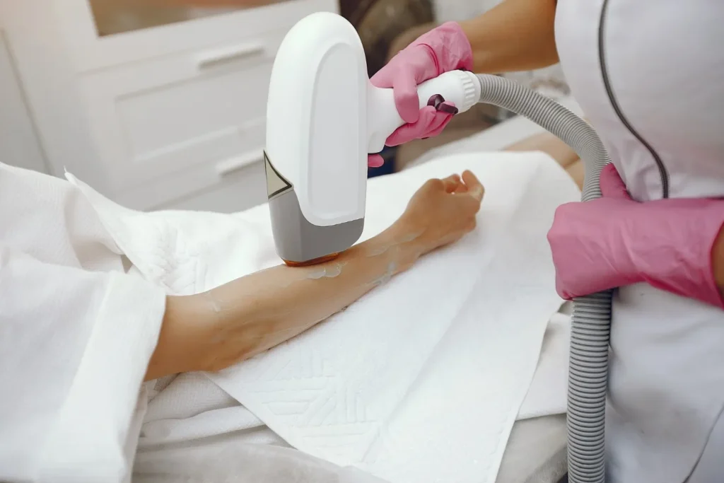 best laser hair removal clinic Chennai