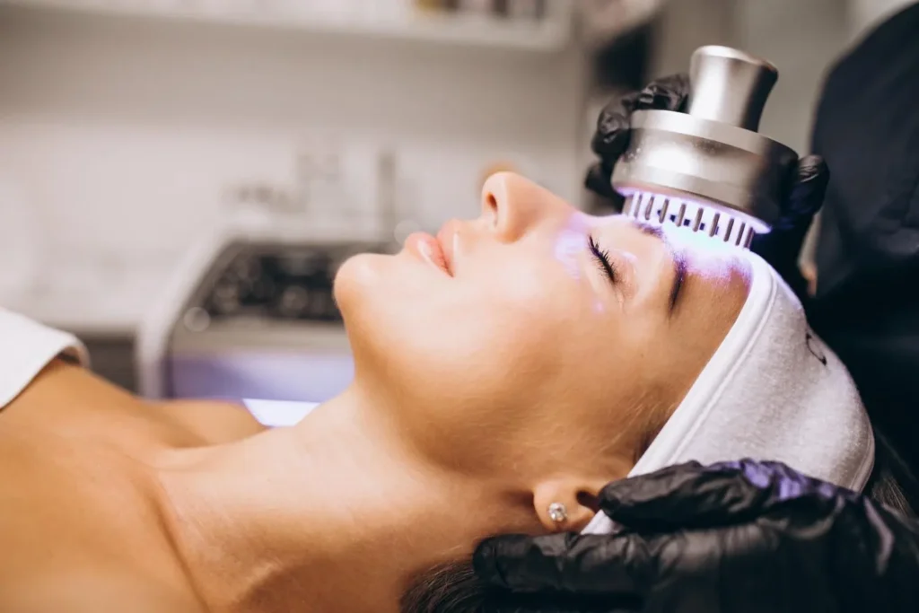 dark spot removal laser treatment