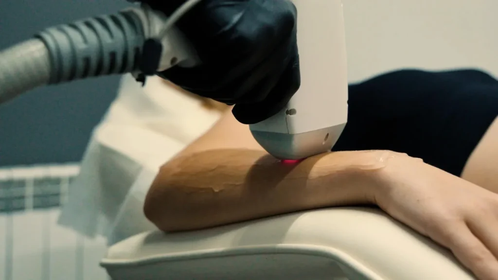 permanent hair reduction Chennai