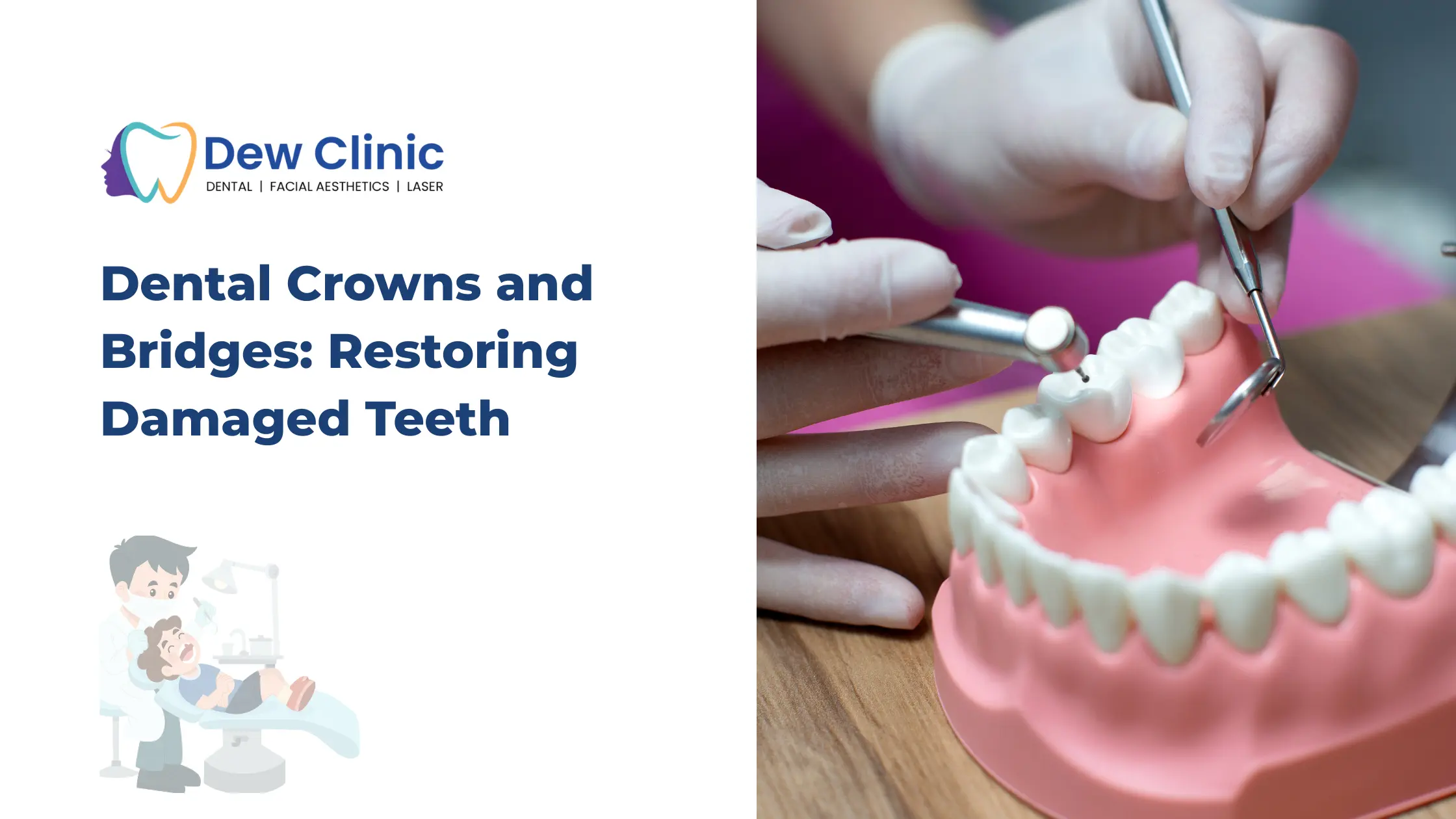 Dental Crowns and Bridges Restoring Damaged Teeth