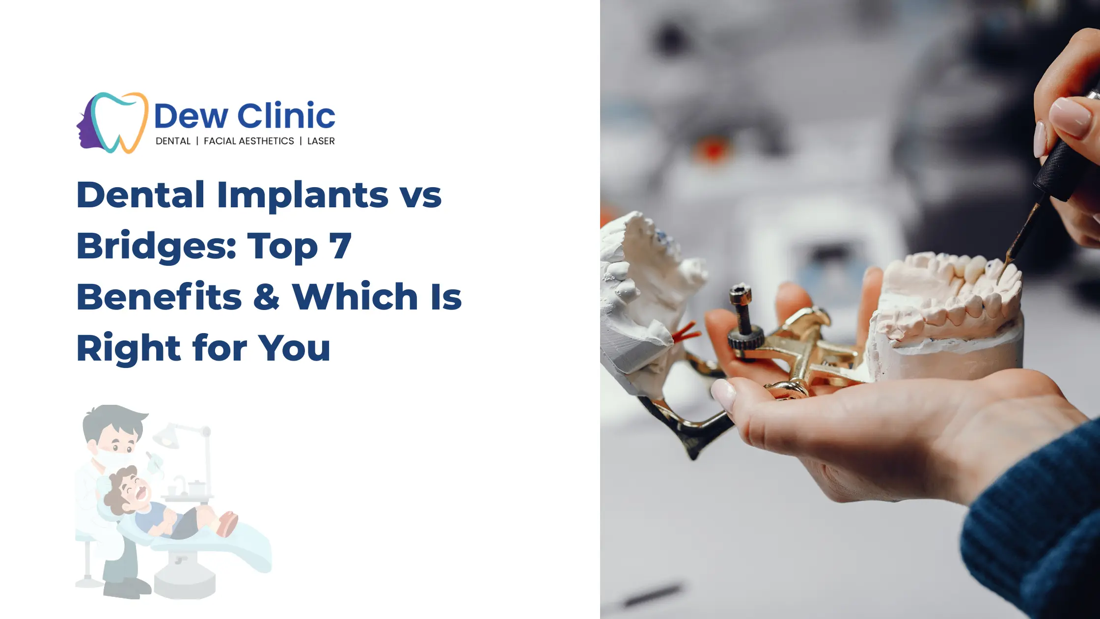 Dental Implants vs Bridges