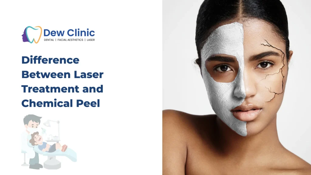 Difference Between Laser Treatment and Chemical Peel
