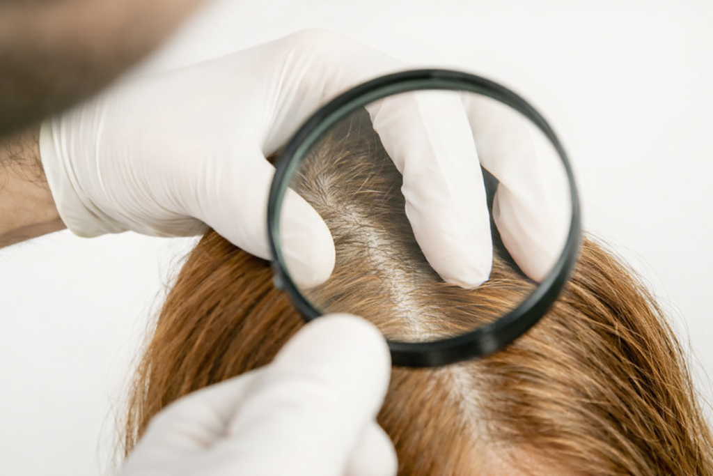 Hair Treatment in Chennai