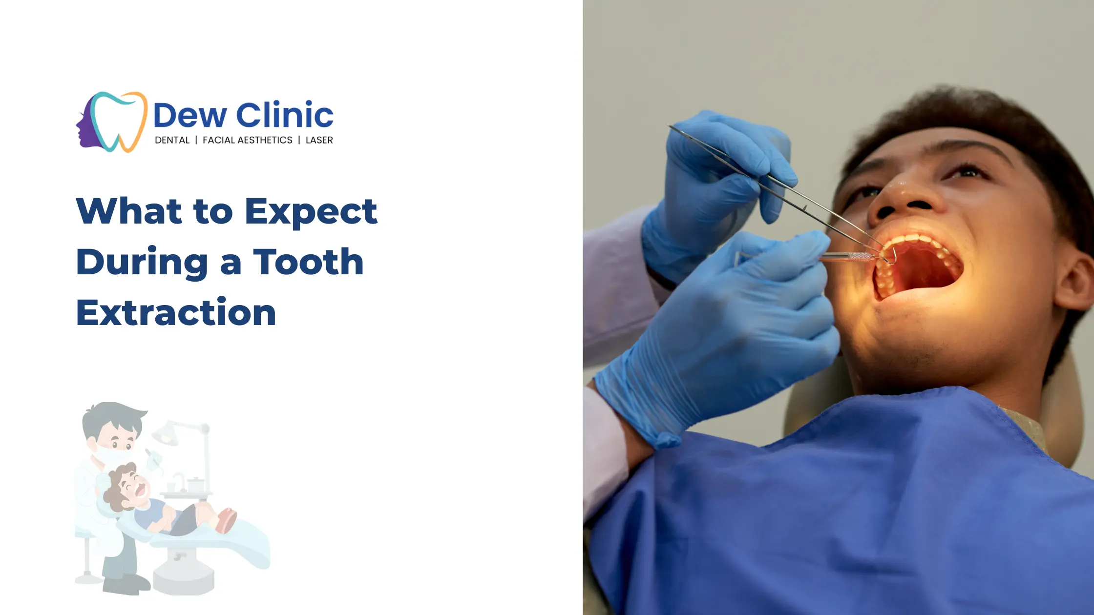 What to Expect During a Tooth Extraction