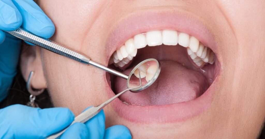 Best Dental Clinic in Chennai
