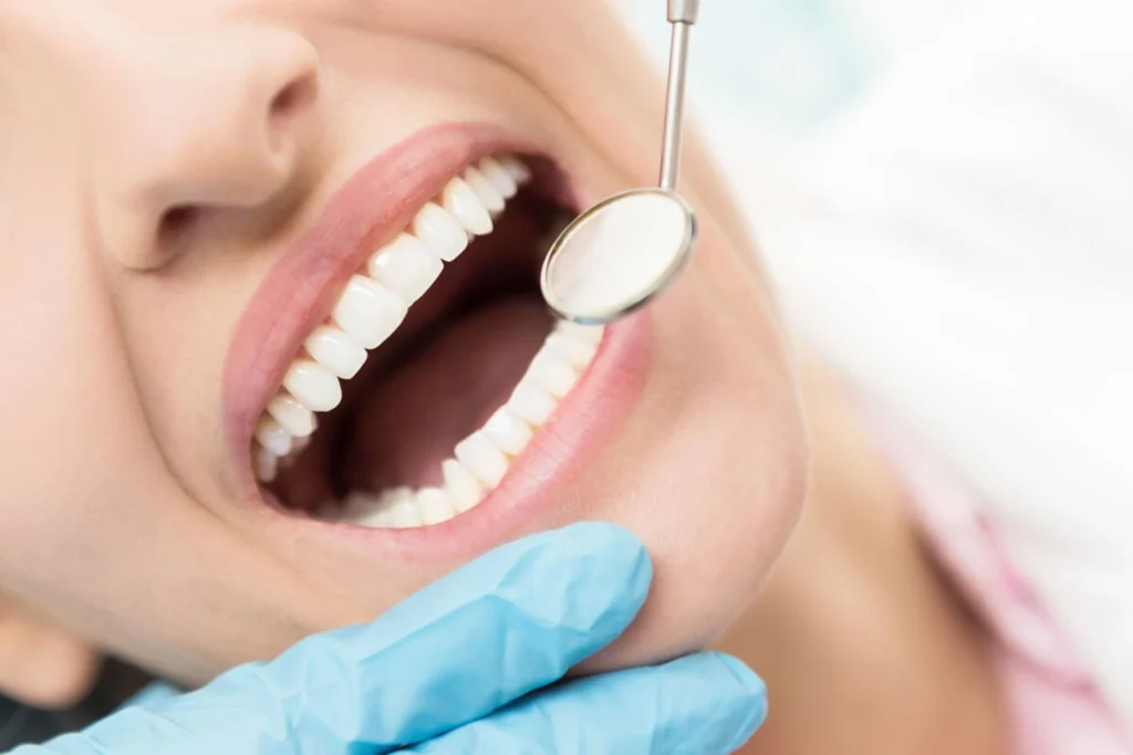 pediatric dentist in Chennai​​