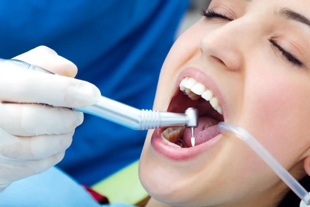 Tooth Filling Treatments for Cavities