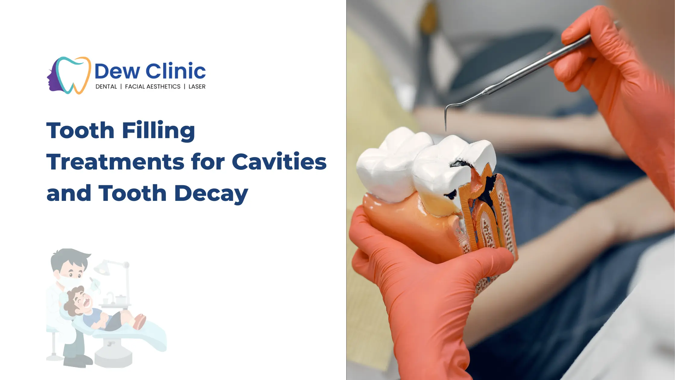 Tooth Filling Treatments for Cavities and Tooth Decay