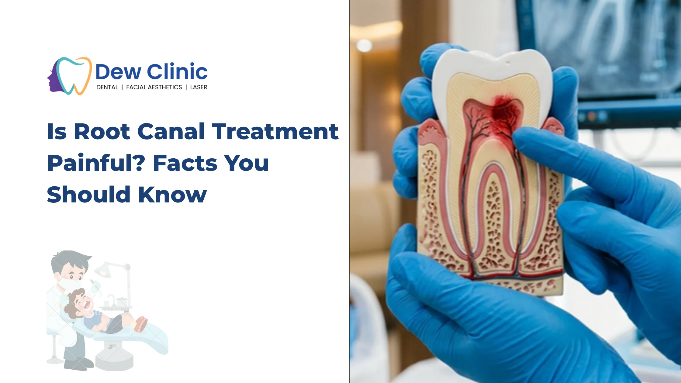 3D cross-sectional model showing an infected tooth and root canal treatment anatomy at a dental clinic in Chennai.
