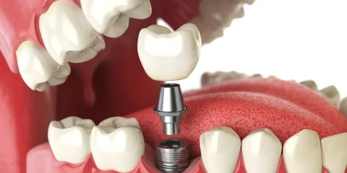 Best Dental Clinic in Chennai